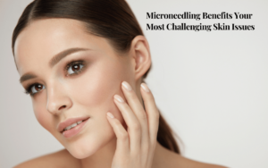 Microneedling Benefits