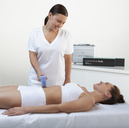 Morpheus8 Microneedling: Body