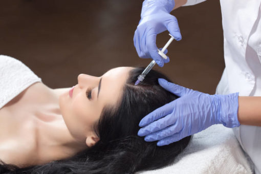 woman receiving scalp injection